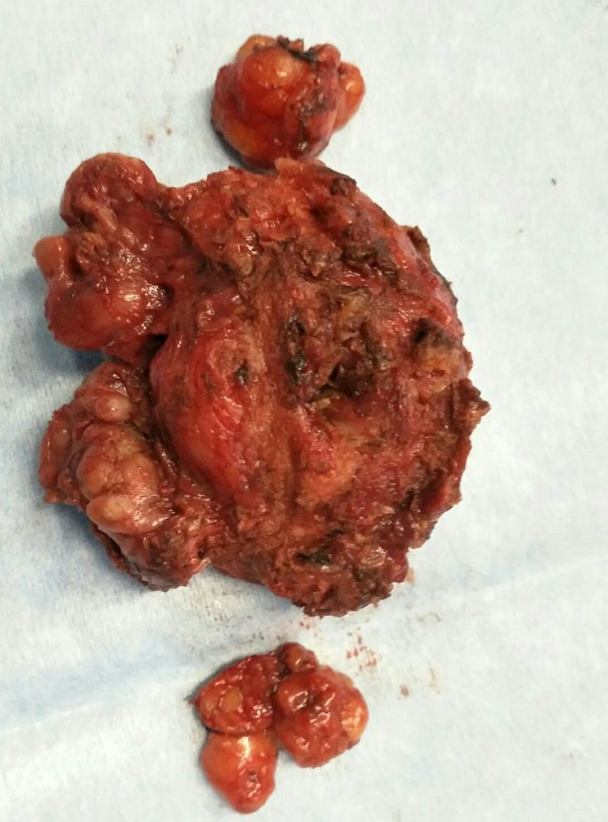 科学防癌,5条健康守则筑起生命防线